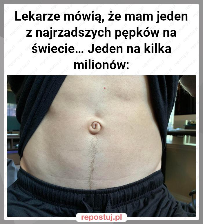 Lekarze mówią, że mam jeden z najrzadszych pępków na świecie… Jeden na kilka milionów: